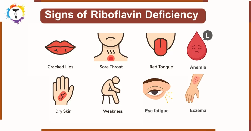 Symptoms of riboflavin deficiency